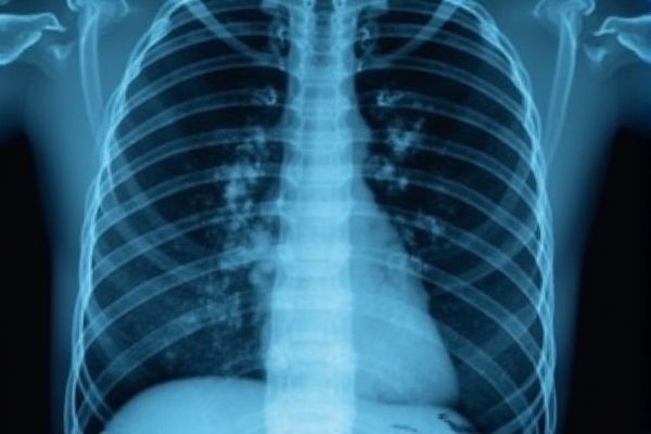 Radiography Job Opportunities in Bangladesh